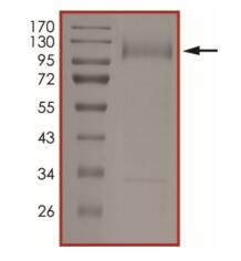 The purity of nCoV-S1 (T19R, ∆157-158, L452R, T478K, D614G, P681R) was determined to be >90% by densitometry